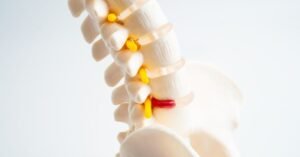 Pilates para Hérnia de Disco